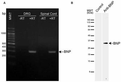 Localization of Brain Natriuretic Peptide Immunoreactivity in Rat Spinal Cord